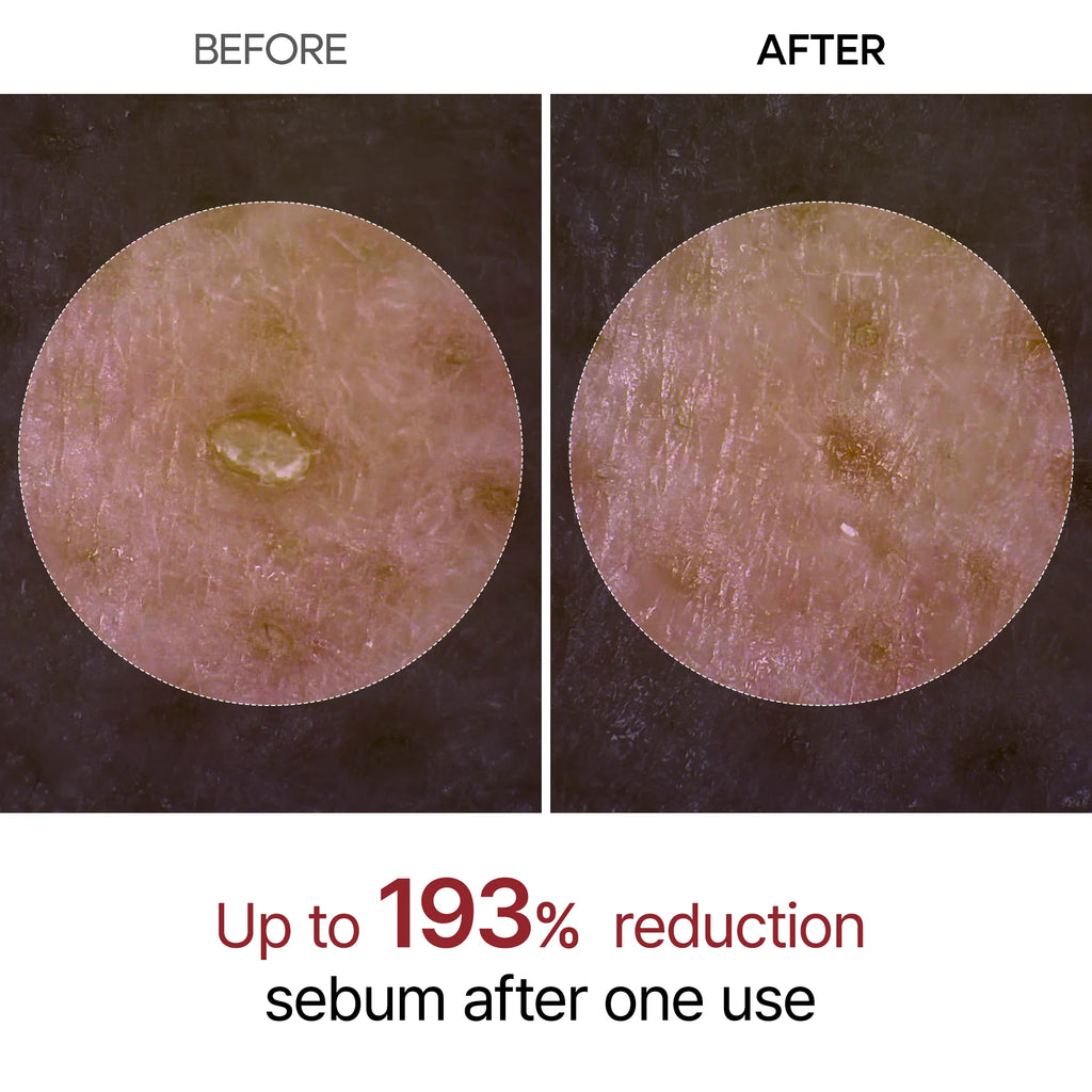 Dr.Melaxin Peel Shot Glow Rice Ampoule - Serums for Brightening, Exfoliating, and Moisturizing