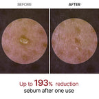 Dr.Melaxin Peel Shot Glow Rice Ampoule - Serums for Brightening, Exfoliating, and Moisturizing